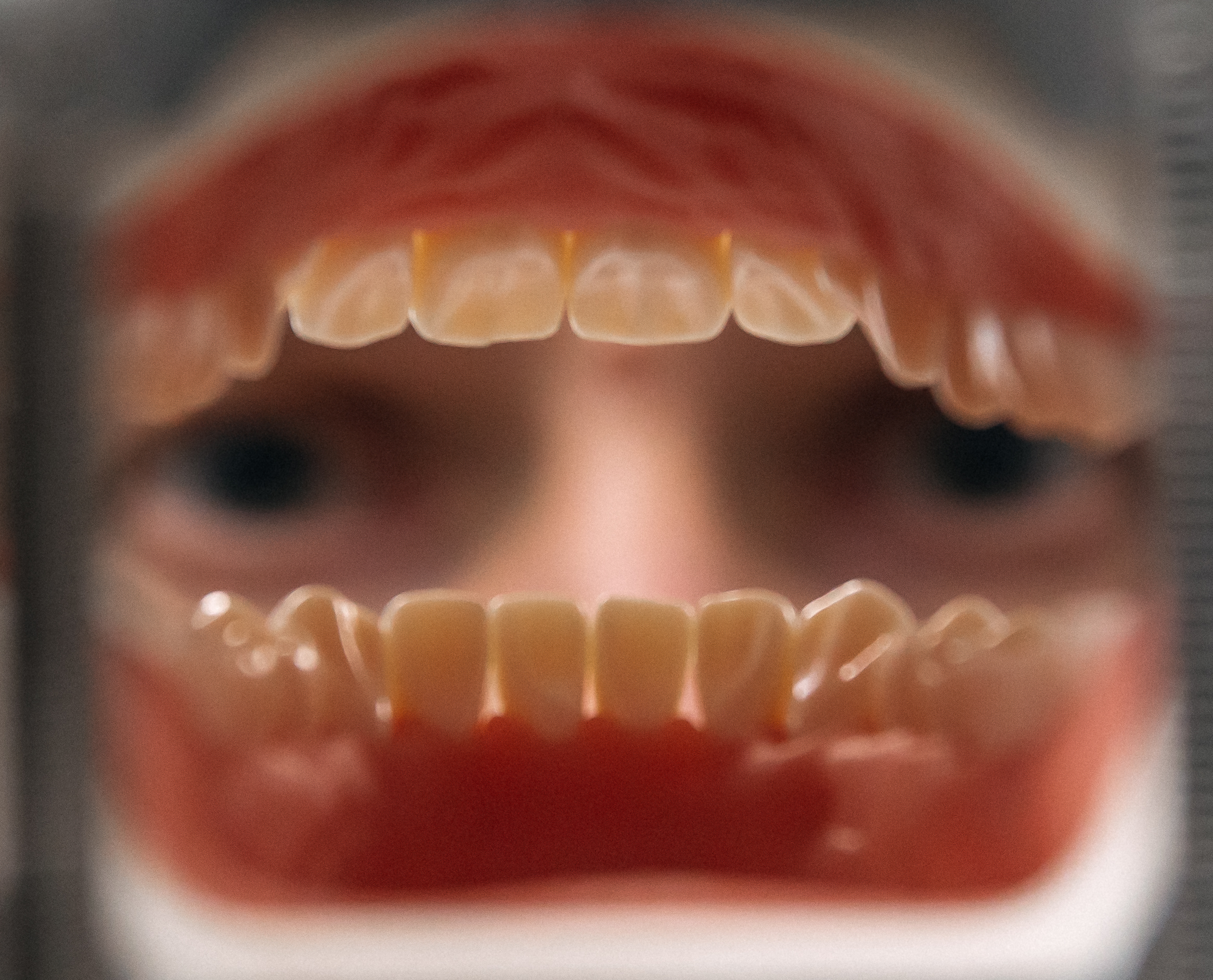 Цифровая имплантация: в чем преимущества этого метода восстановления зубов?